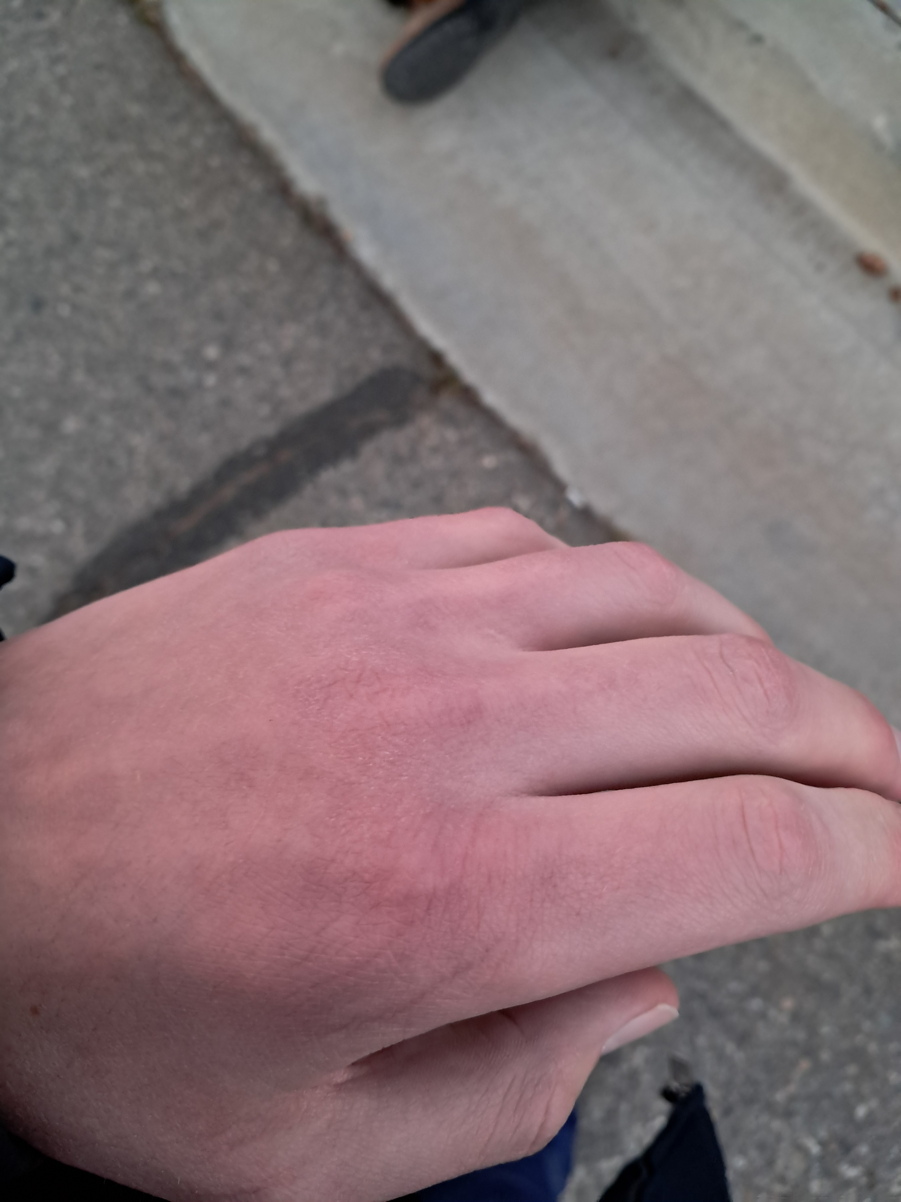 My knuckles don't look as purple in the picture as they did in reality. (50° without sun isn't too bad until the wind is going at least 15 MPH and you are biking against it)